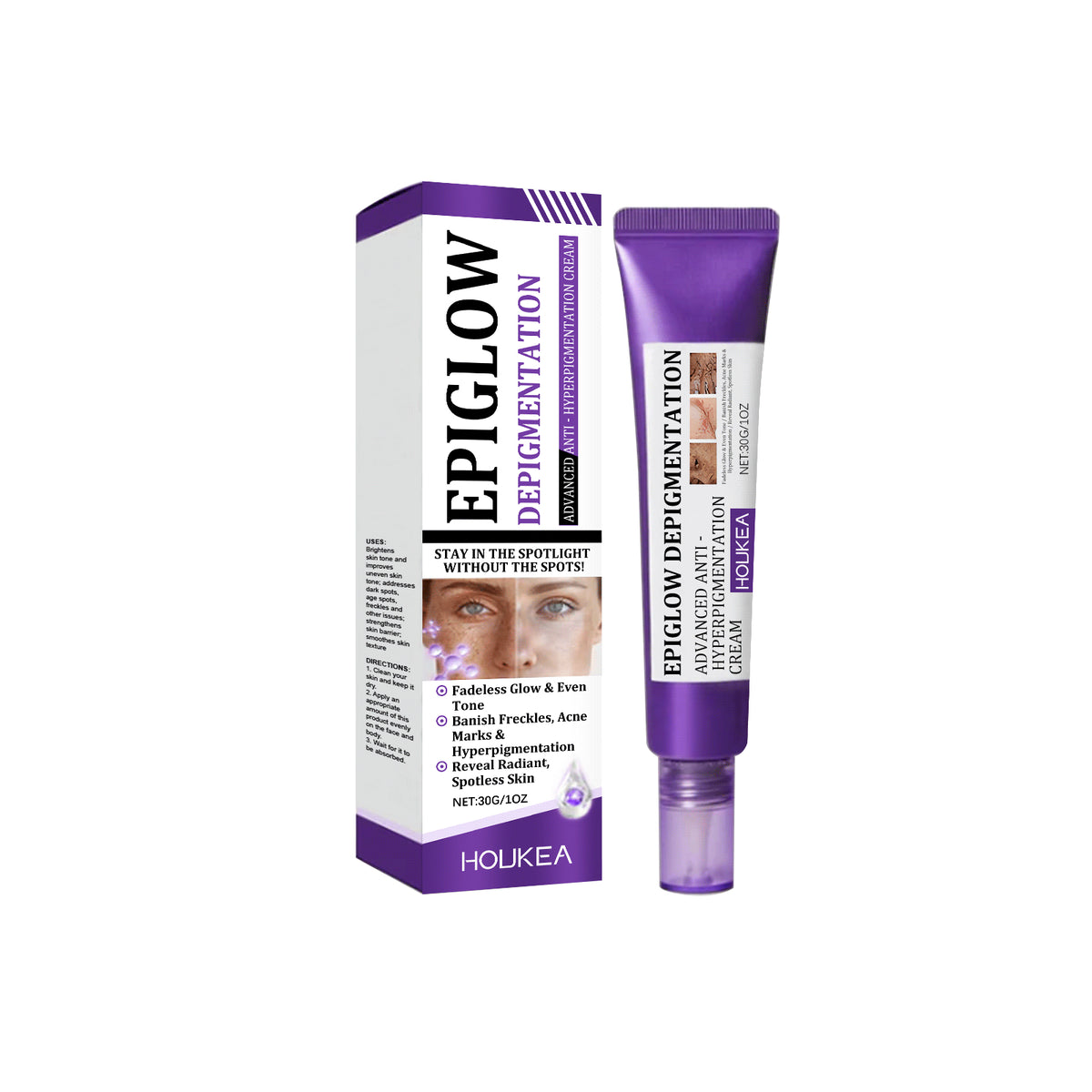 Retinol Freckle Removing Cream 30g - Skin Brightening & Spot Treatment