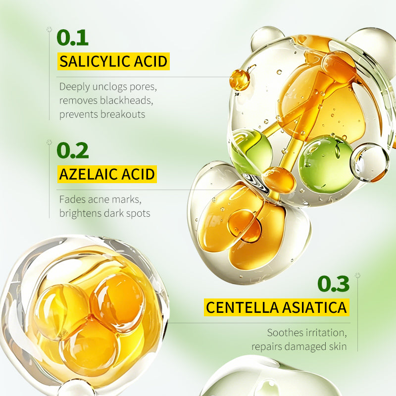 Salicylic Acid Acne Cream 30g