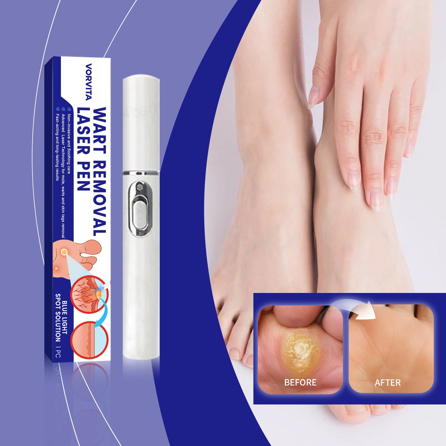 Face Skin Care Laser Pen - Anti-Aging Skin Treatment Tool