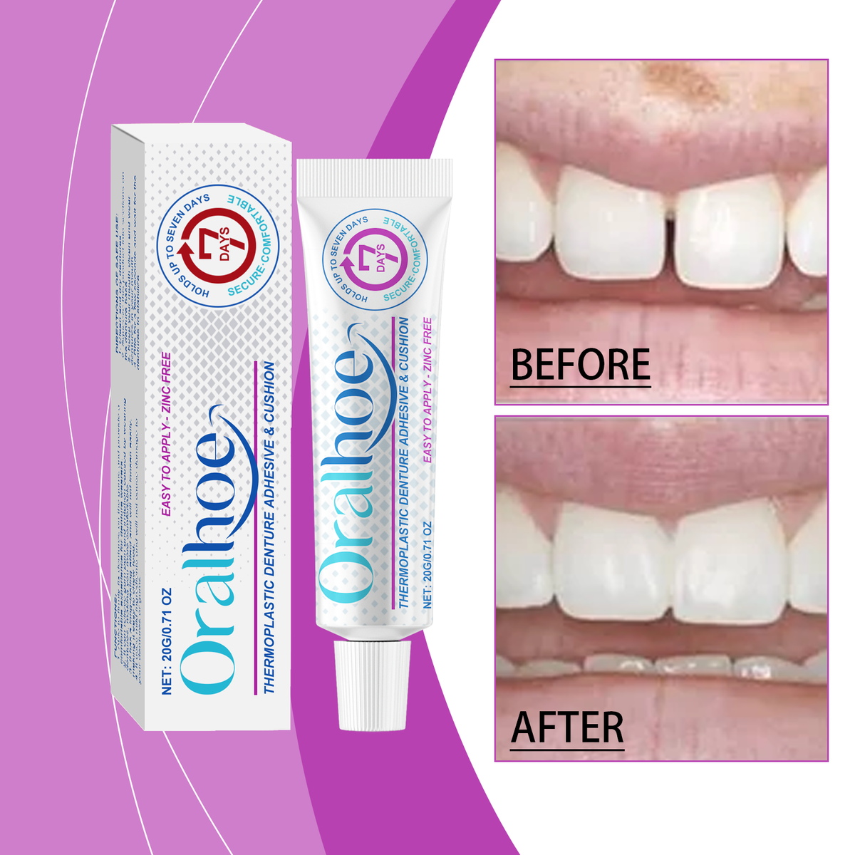 Denture Adhesive 20g