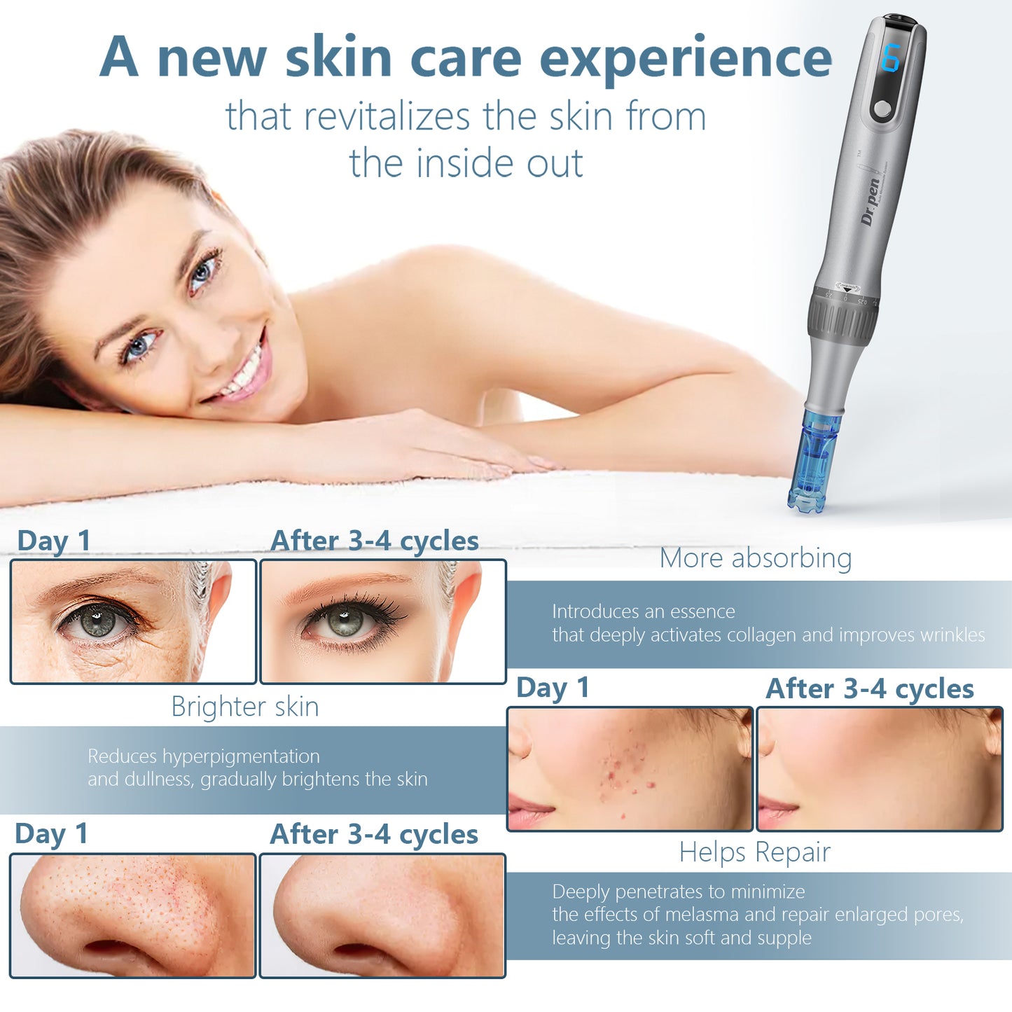 Microneedle Derma Roller Pen with 15 Replacement Heads - Skin Rejuvenation Tool