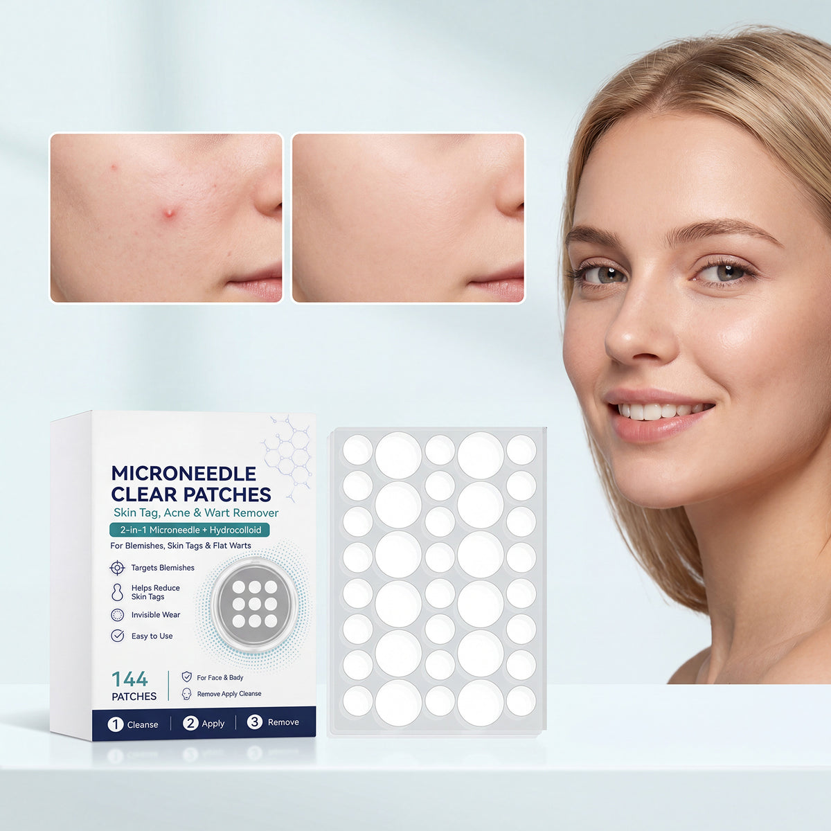 Acne Microneedle Patch - 144 Pieces Per Box