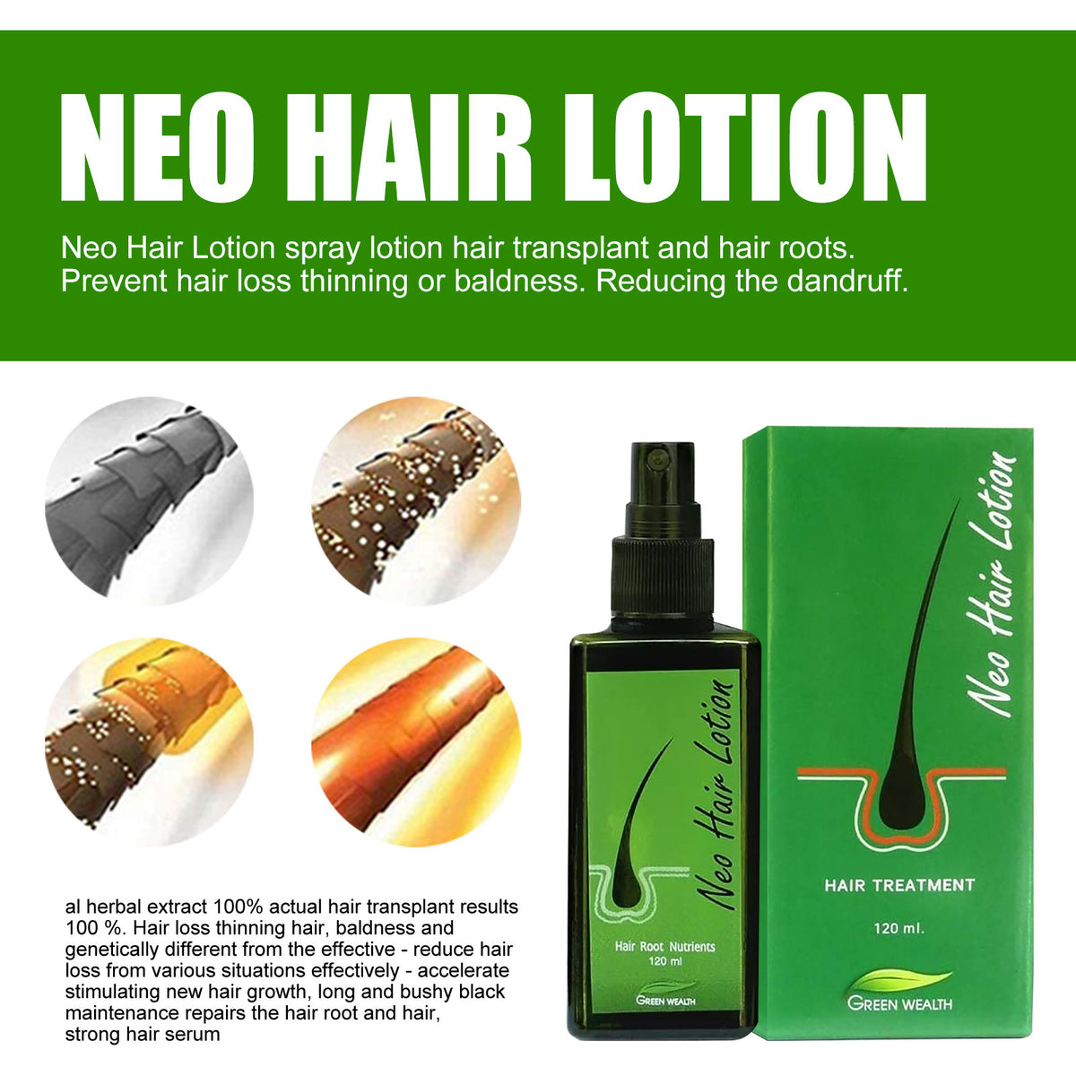 Hair Growth Lotion Spray 120ml