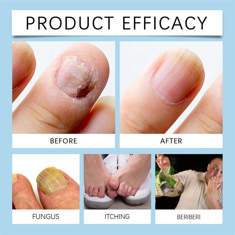 Nail Cleaning Liquid 20ML Antiseptic Cuticle Remover & Sanitizer