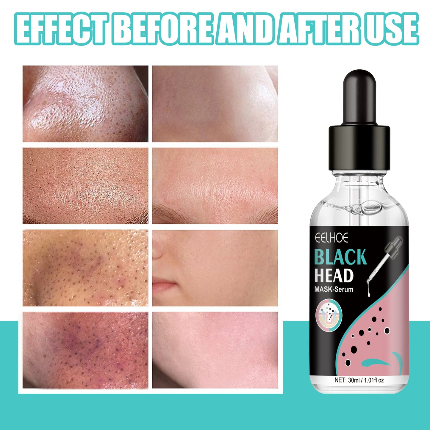 Blackhead Removing Nose Mask - Pore Cleansing & Smoothing Liquid Serum