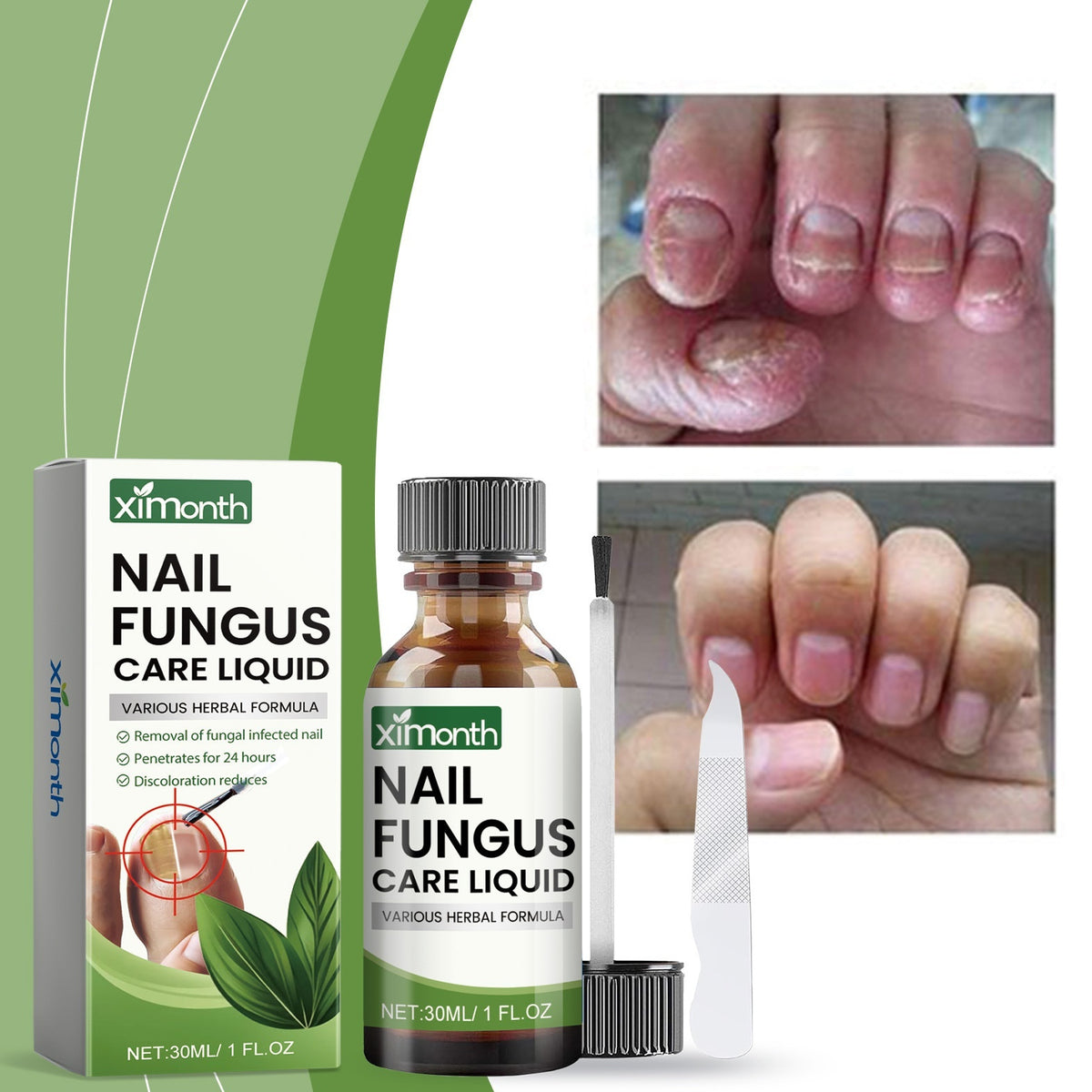 Portable Home Hand And Toe Nail Repair Suit