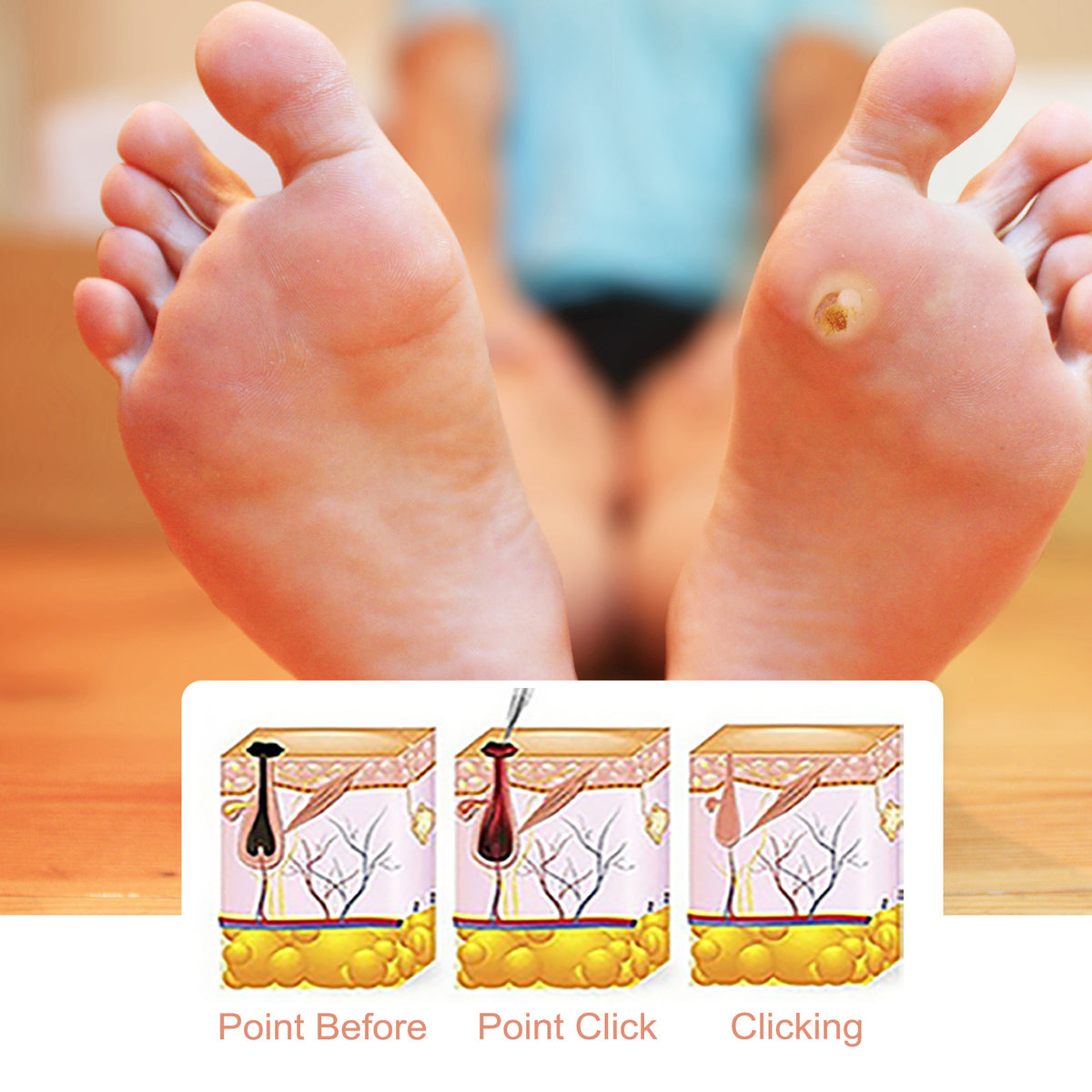 Foot Care Cream – Cleanses & Moisturizes Skin, 29g