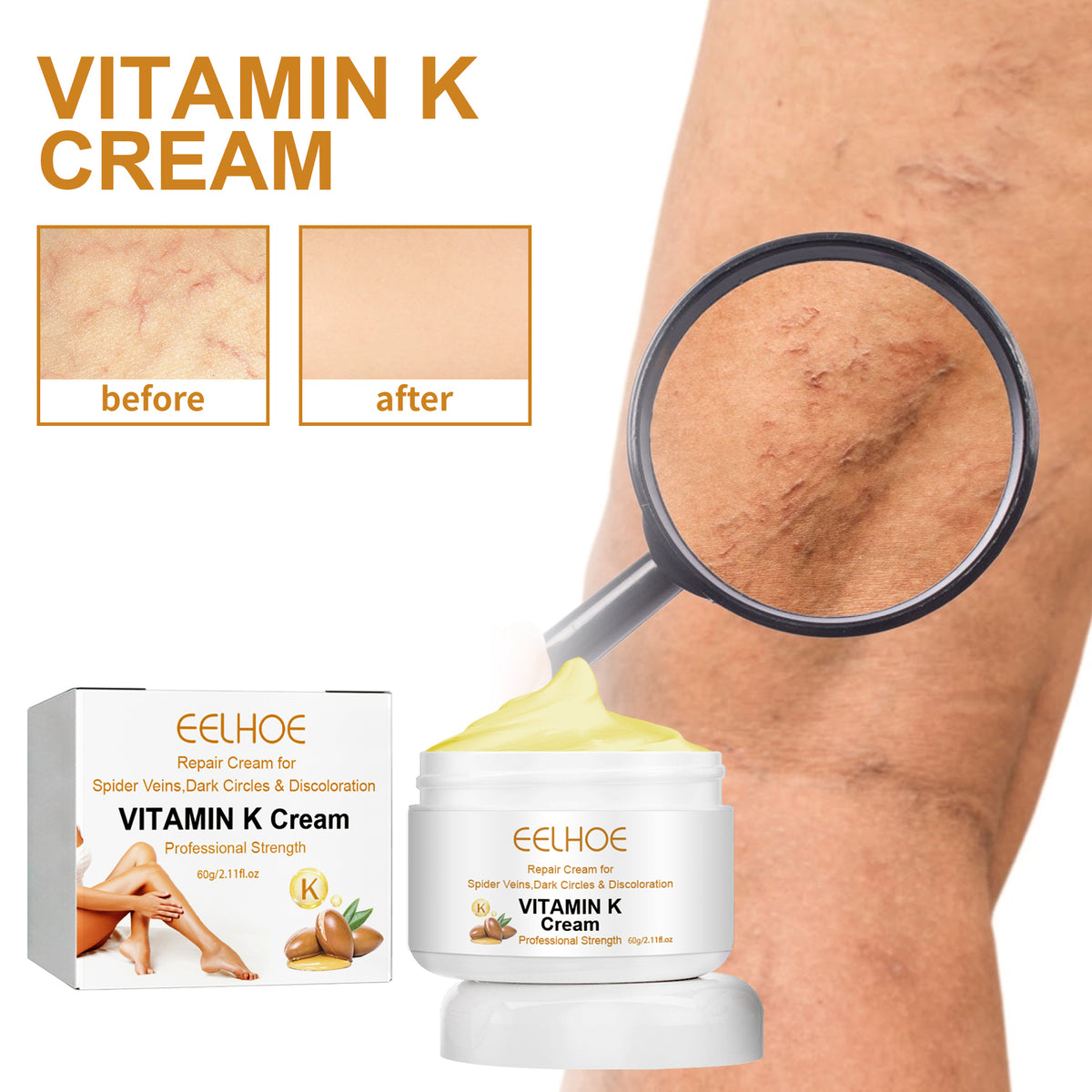Vitamin K Cream 60g - Varicose Vein & Bruise Relief