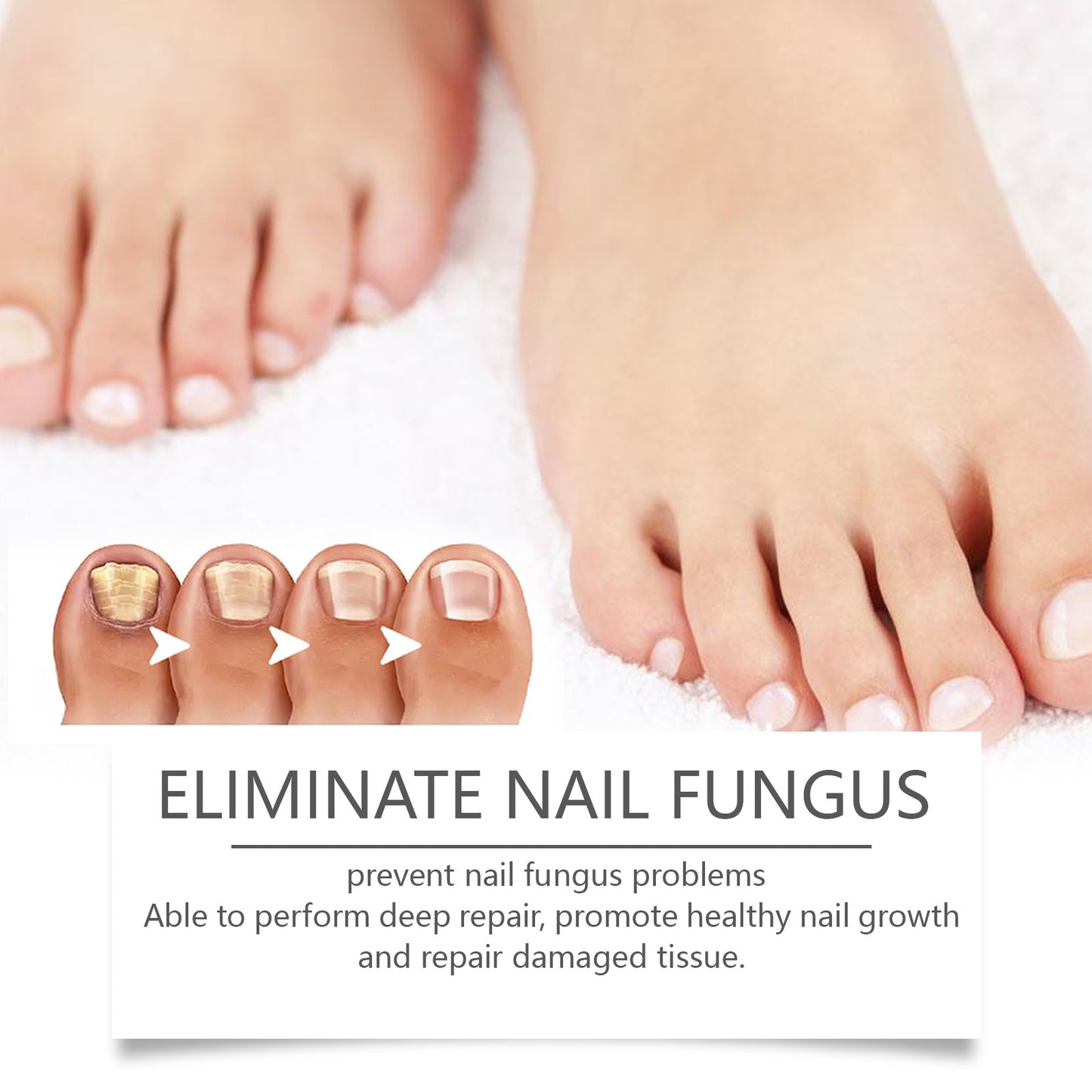 Nail Repair Pen for Damaged Nails - Moisturizing & Strengthening Treatment