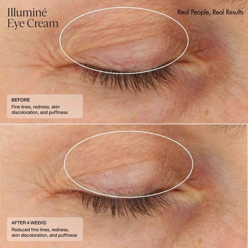 Senté Illuminé Eye Cream | Diminish Dark Circles, Discoloration, Redness, and Puffiness Around The Eyes | with Patented HSA, Niacinamide and Peptides | 0.5 Oz