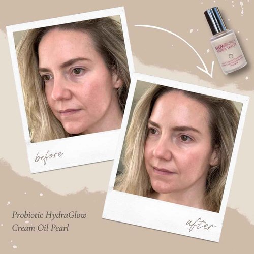Glowbiotics Probiotic HydraGlow Cream Oil Pearl: Radiance-Boosting Glow Drops for Bright, Hydrated Skin | Pearl Essence & Skin Brightening