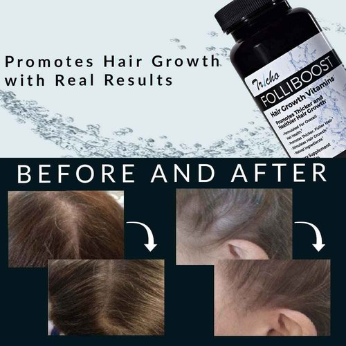 Folliboost Tricho Hair Growth Vitamins - Biotin, Vitamin C, Zinc & Vitamin B12 - Hair Care Capsules for Thicker, Fuller & Healthier Hair - 3 Pack