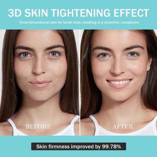 Upgraded Version | Skin Care Device - Facial Glow Booster for Maximizing and Boosting Skin Care Absorption - Needle Free, Radiance, Elasticity | LED Anti-Wrinkle Device | Skin Care Firming, Toning