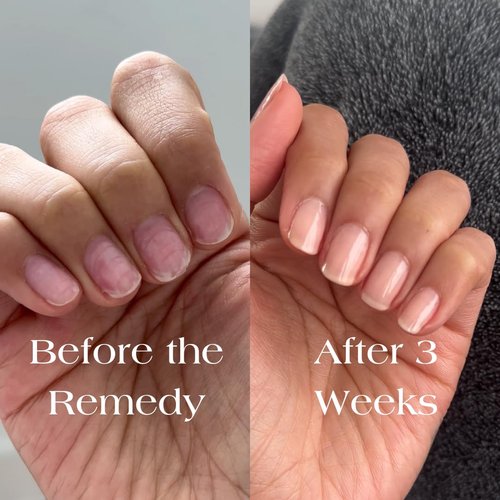 Botanist Nail Strengthening Manicure Kit | Everything Needed for Longer, Stronger Nails | Grow and Strengthen Damaged Nails | Non-Toxic, 84% Plant Based, 21-Free & Vegan (Nude)