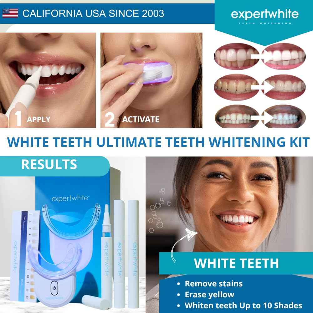 Instant Glo Teeth Whitening Kit with 32x LED Accelerator Light, Best Smile Whitener Gel Pens. Fast Results, for Sensitive Teeth, Enamel-Safe, Dentist-Trusted Incl. Mouth Tray, UV Light Whitening Kit