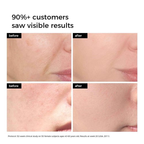 WNP Hyaluronic Acid Serum 3% for Face with 4D Multi-Layer Hydration | Ultra Hydrating Anti-Aging Serum | Moisturizer for Dry & Sensitive Skin | Pre-Makeup Skincare | Single-Use Vials 100PCS