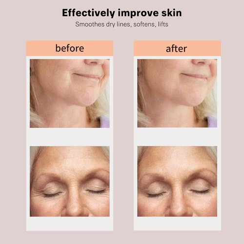 Ms.W 3-in-1 Beauty Massager for Face and Neck, Facial Massager with Heat, Vibration and Led, Electric Face Massager for Skin Improve, Smooth, Firm