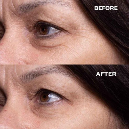 Wrinkles Schminkles Faux-Tox Face Bundle Set: Silicone Patch Cleanser, Forehead Wrinkle Patches & Under Eye Wrinkle Patches