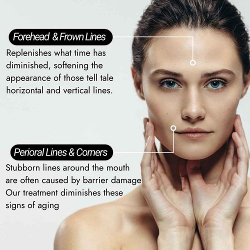 Cellular Dermatology CDERMA Anti-Aging Face Cream Fights Wrinkles, Firming & Hydrating Moisturizer with Dual Hylauronic Acid For Dry Skin, Sensitive Skin, Aging Skin Made in France, 1.76 fl oz