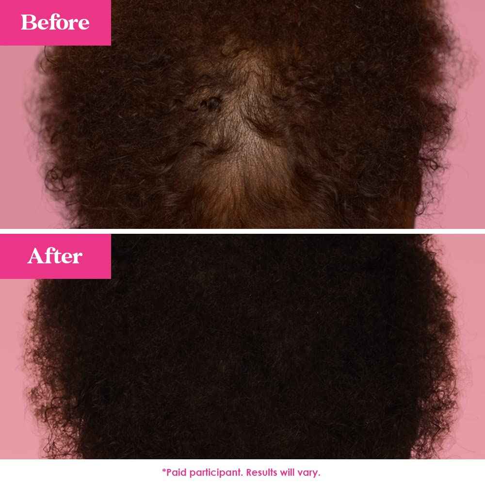 Grande Cosmetics GrandeHAIR Enhancing Hair Serum - for Men & Women, for Fuller & Thicker-Looking Hair in 8 weeks, Safe for Color-Treated Hair (40 mL)