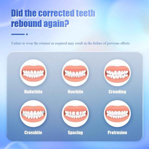 Custom Fit Hawley Retainer After Braces, Durable Dental Retainer, Upper & Lower Hawley Retainers for Teeth for Adults & Kids, 2 Pack