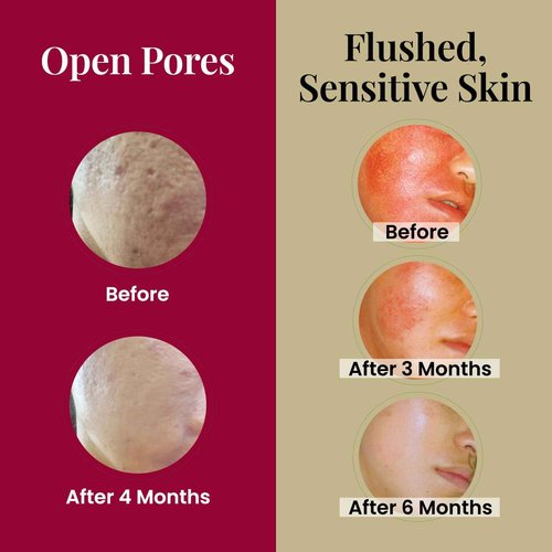 LABO Nutrition Le Revital Concentrated Nano Placenta Extract Serum Essence from Japan – Hydrating, Glowy, Moisturizing for Face Wrinkles, Dull Skin, Tone, Soothing & Skin Barrier Strength | 4 Vials