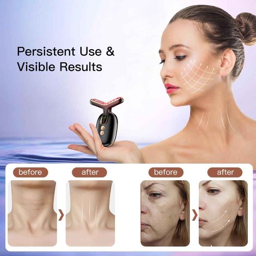 Facial Beauty Device for Face and Neck, 3 Color Facial Massager for Skin Care with Thermal, Vibration, Black