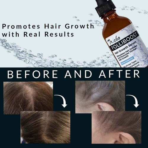 Tricho Labs Folliboost Hair Growth Serum - Natural-Based Formula w/Biotin & Peppermint Oil - Hair Care for Thicker & Fuller Hair - 2oz, 3-Pack