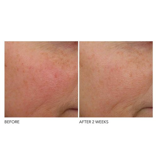 Dr Dennis Gross Advanced Retinol + Ferulic Overnight Wrinkle Treatment: Visibly Firm, Restore Hydration & Reduce the Look of Wrinkles, 1 oz