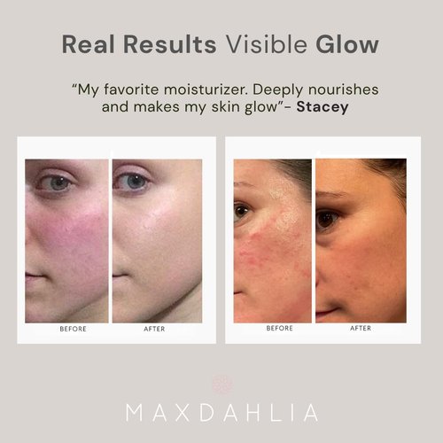 MAXDAHLIA HydroFlora Barrier Repair Face Oil Gel– Anti-Aging Moisturizer for Deep Hydration & Skin Barrier Support with Abyssinian, Babassu & Bakuchiol | Lightweight, Non-Greasy Facial Oil