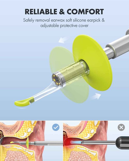 Anykit Digital Otoscope with Gyroscope, 4.5 Inches Screen, 3.9mm Ear Scope Camera with 6 Lights, Ear Wax Removal Tool, 32GB Card, Supports Photo Snap and Video Recording