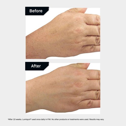 Revision Skincare Lumiquin® Hand Cream, Anti Aging Hand Moisturizer, Supports Moisture Barrier, Skin Brightening, 1.7 oz