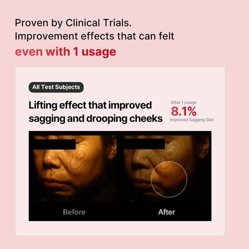 Shumage Cream + Device & Shumage Gold Seal Lifting Cream - Moisturizer Face Lift Cream, Hydrating & Tightening for Sagging Skin - Microcurrent Facial Device for Radiant Glow Skin - Korean Skincare