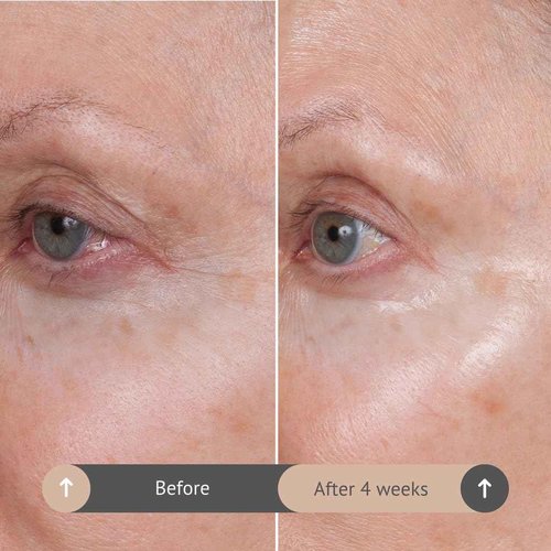 Consult Beaute Volumagen TRIO Skin Care For Plumper & Smoother Skin - Collagen, Hyaluronic Acid and Ceramides - Doctor Formulated for Face, Neck and Eyes - Boost Moisture for Glowing Complexion