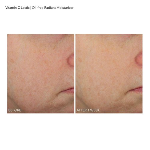 Dr Dennis Gross Vitamin C Lactic Oil-Free Radiant Moisturizer: For Dullness, Uneven Tone & Texture, Fine Lines and Occasional Dryness, 1.7 oz