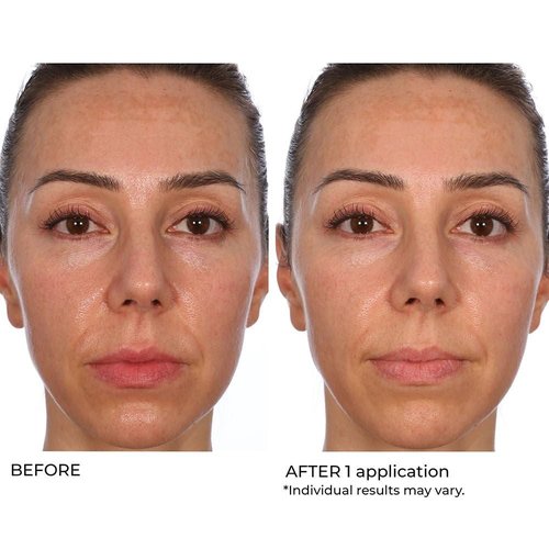 NassifMD Hydro-Gel with Hylauronic Acid Moisturizer, Salicylic Acid Serum, Retinol Serum for Face