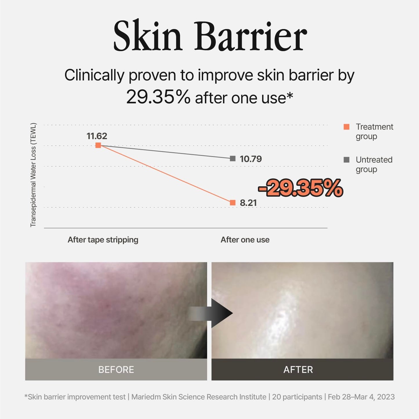 Groundplan Silver Shield Mist - Facial Barrier Toner Spray, 80% Witch Hazel Water, Centella Asiatica for Skin Barrier Repair, Recovery Calming Mist for Sensitive Skin, Korean Skin Care (11.16 fl oz)