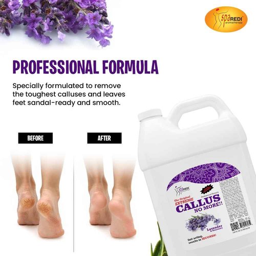 SPA REDI Callus Remover - Removes Toughest Calluses in Seconds and Smooths Dry Cracked Heels, Softens and Smooths Feet, Lavender & Rosemary - 128 Oz