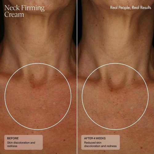 Senté Firming Neck Cream for Crepey Skin & Vertical Lines | Lifts, Firms & Smooths Neck & Décolleté | HSA, Caffeine, Vitamin C | 1.7 Fl Oz
