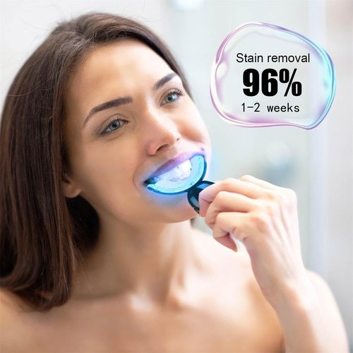 The Teeth whitening kit has Teeth whitening Trays, Wireless LED Teeth whitening Lights, and 4 Teeth whitening pens. Sensitive Teeth Whitening Kit - Removes Years of Stains and whitens Teeth