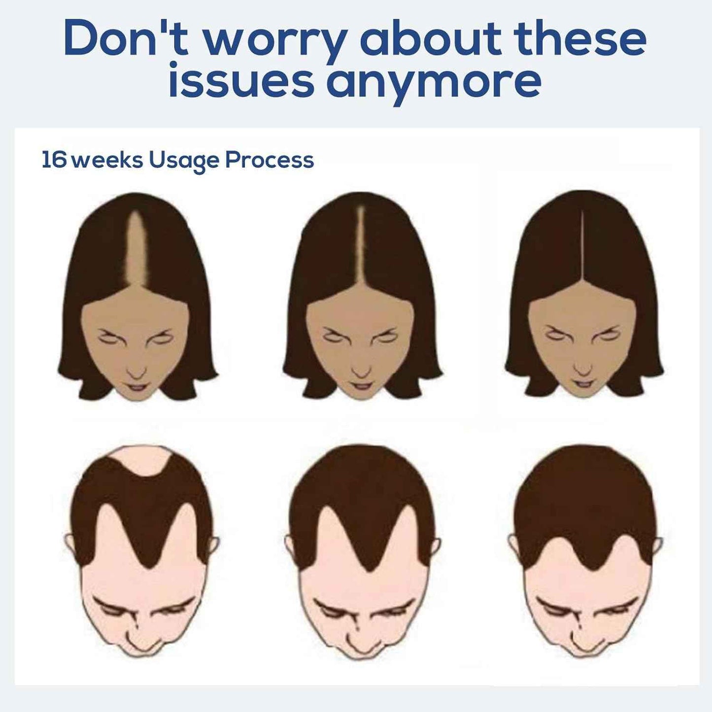 Laser Therapy Hair Growth Comb