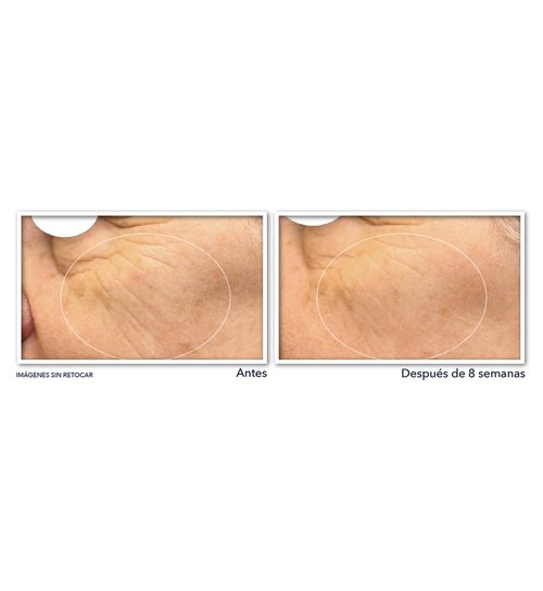 RoC Multi Correxion Revive + Glow 20% Pure Vitamin C Night Serum Capsules for Brightening, Dark Spots, and Texture, 30 count