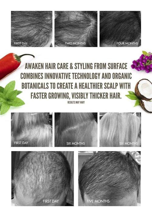 SURFACE Hair Awaken Therapeutic Conditioner, Healthy Hair Conditioner with Protein, Thickening Conditioner, Treatment for Thinning Hair and Hair Loss, 33.8 oz