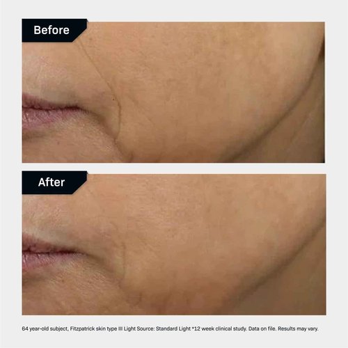 Revision Skincare D·E·J Face Cream®, Advanced Anti Aging Moisturizer, Lifting and Firming, Antioxidant Rich, 0.5 oz