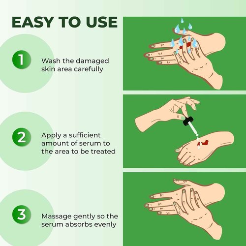 ABERA Alan Silver Serum – Botanical Hydrating Serum for Dry & Sensitive Skin & Herbal Extracts – Daily Moisturizer for Face, Body & Scalp – Fast Absorbing, Lightweight – 3 boxes