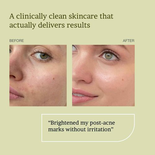 MAXDAHLIA Cell Active Day Serum | 10X Antioxidant Protection | Small-Batch Non-Oxidizing 20% Vitamin C+E Ferulic Acid with Niacinamide & Hyaluronic Acid | Anti-Aging, Brightening, Dark Spot Corrector