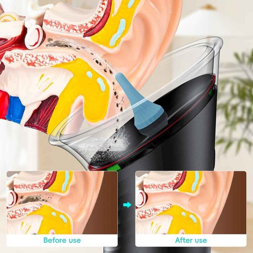 Ear Wax Removal with LED Display, Temodu Electric Ear Cleaner, Rechargeable Earwax Remove Removal Ear Irrigation System, 3 Pressure Modes Ear Cleaning Earwax Removal (12 Disposable Tips)