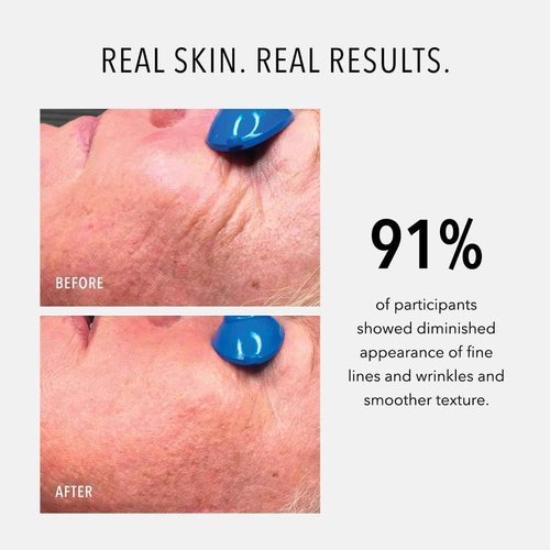 HydroPeptide Nimni Cream, Patented 0.25% Retinol Collagen Support, Anti-Aging Booster Cream, Improves Skin's Fullness and Elasticity, 0.5 Ounce