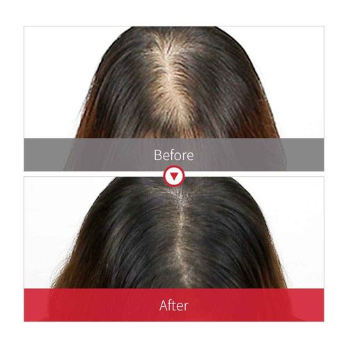 JSOOP Red J Shampoo 500ml(16.9 fl.oz) / Anti-hair loss, Low skin irritation, Reduces redness of the scalp