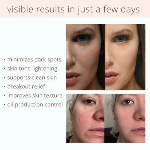 Coffeeface Anti-Aging Moisture Pads with Exfoliation, 32 count